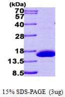 Human HRSP12 / UK114 Protein (Recombinant His)