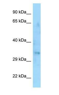 SYPL1 Antibody (C-Terminus)