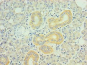 Polyclonal Rabbit anti-Human PDLIM1 Antibody (aa1-329, IHC, WB)