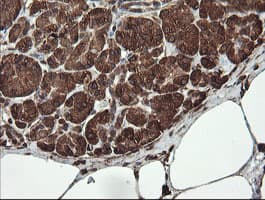 REEP5 Antibody (clone OTI4D2)