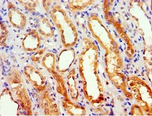 Polyclonal Rabbit anti-Human GEM / KIR Antibody (aa1-150, IHC)