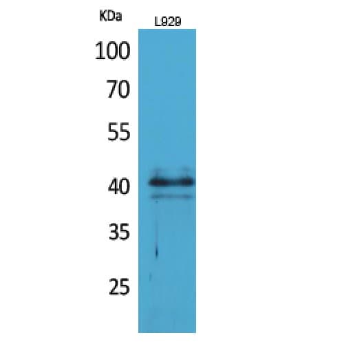 Polyclonal Rabbit anti-Human CCR4 Antibody (1-50 aa, N-terminal, WB)