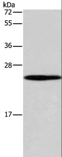 GUK1 / Guanylate Kinase 1 Antibody
