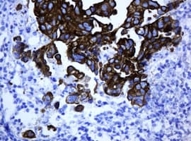 ABCB1 / MDR1 / P Glycoprotein Antibody (aa995-1280, clone 6H2, Carrier-free)