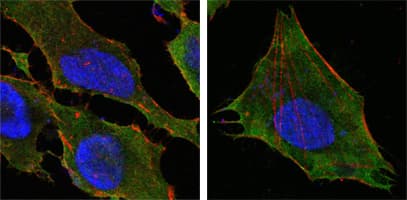 IHC-plus™ S100A10 Antibody (clone 4E7E10)