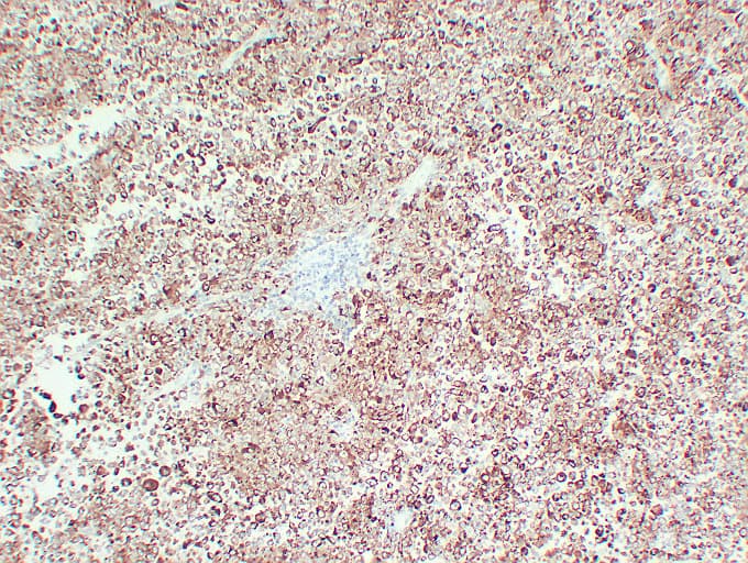 Monoclonal Mouse anti-Human Tyrosinase Antibody (clone ABT-TYR, IHC)
