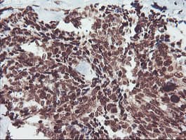 FMR1 / FMRP Antibody (clone OTI1C6)