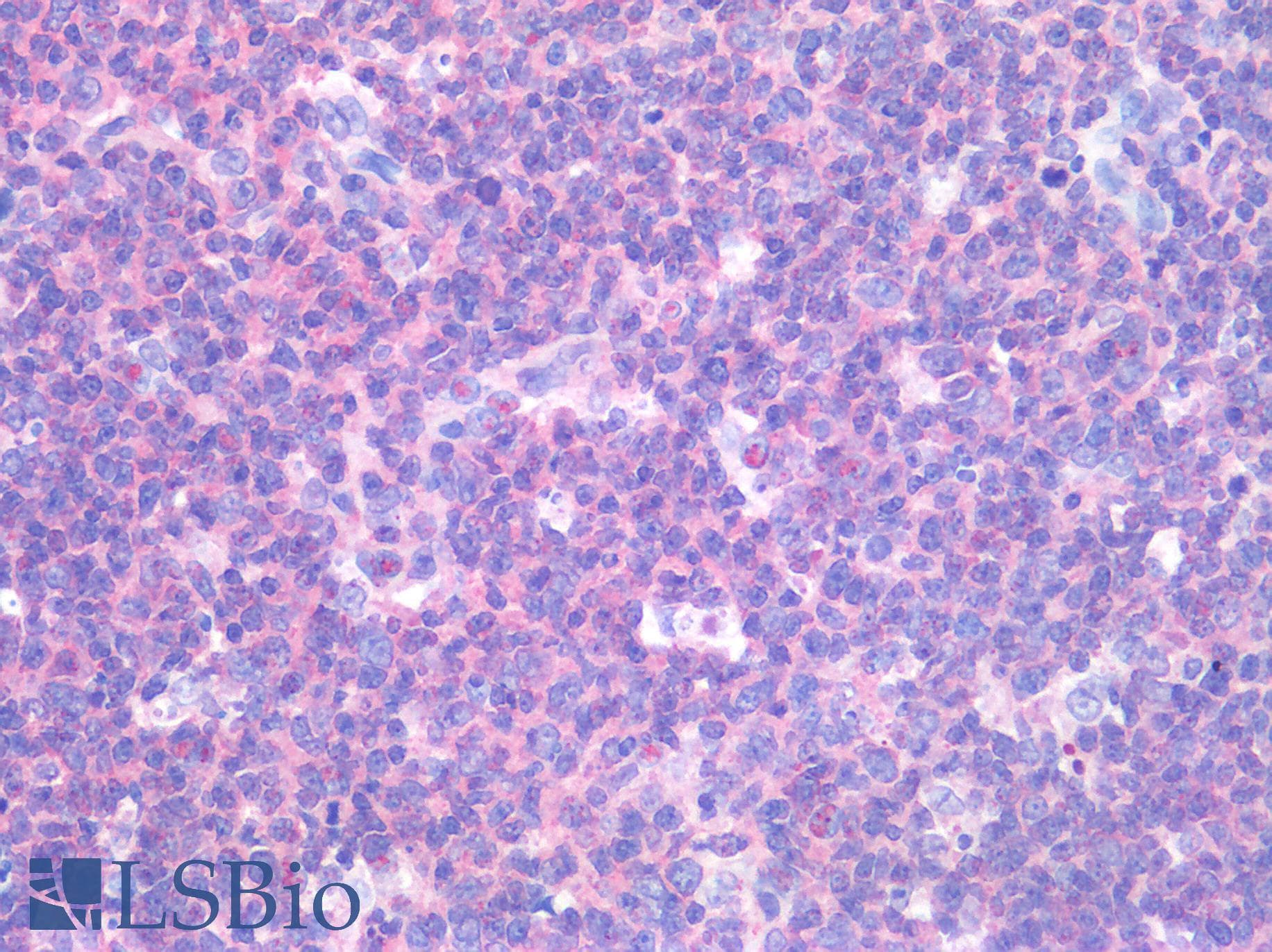 IHC-plus™ Polyclonal Rabbit anti-Human C3AR / C3a Receptor Antibody (C-Terminus, IHC)