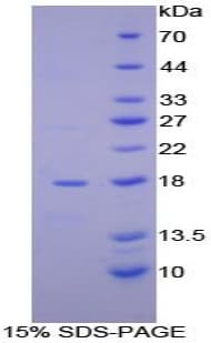 Human AHSP / EDRF Protein (Recombinant His, N-Terminal)
