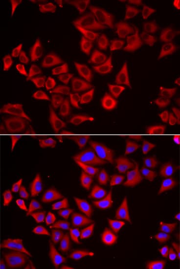 IHC-plus™ Polyclonal Rabbit anti-Human SRGN / Serglycin Antibody (IHC, IF, WB)