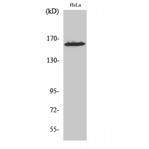 Polyclonal Rabbit anti-Human ZNF608 Antibody (1200-1280 aa, C-terminal, IHC, WB)
