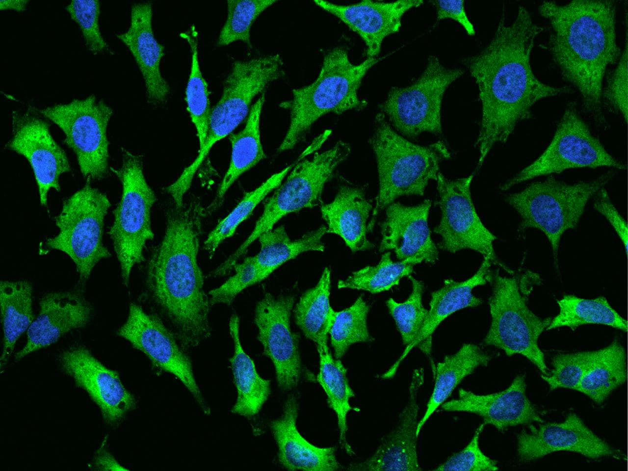 Protein S Antibody (Preservative Free)