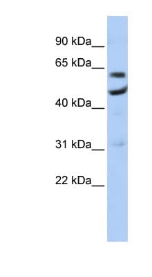Polyclonal Rabbit anti-Human CNOT6 Antibody (aa35-84, WB)