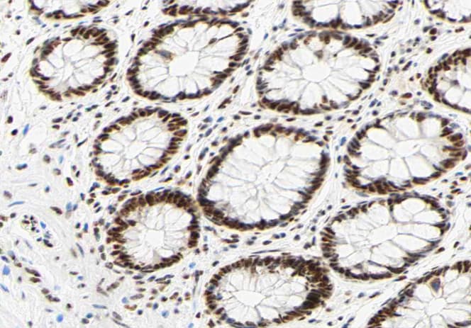 HNRNPC / HNRNP C Antibody (phospho-Ser260)