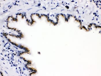 ARSA / Arylsulfatase A Antibody