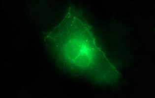 CLDN6 / Claudin 6 Antibody (clone OTI3G3)