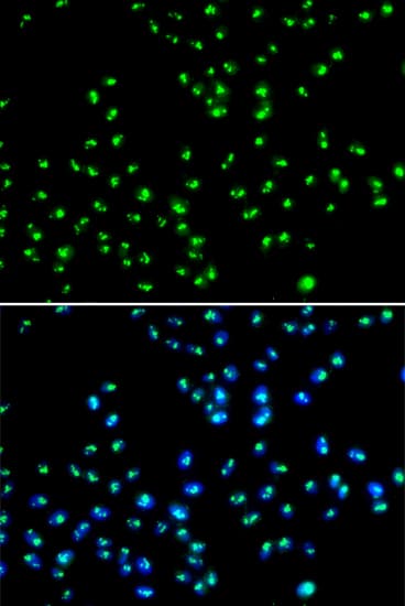 Polyclonal Rabbit anti-Human NAT10 Antibody (IHC, IF, WB)