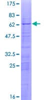 Human RPL6 / Ribosomal Protein L6 (Recombinant GST)