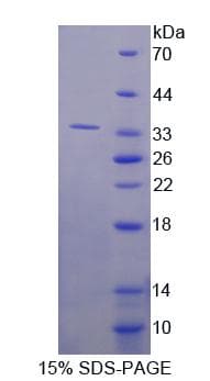 Human RSU1 Protein (Recombinant His-T7)