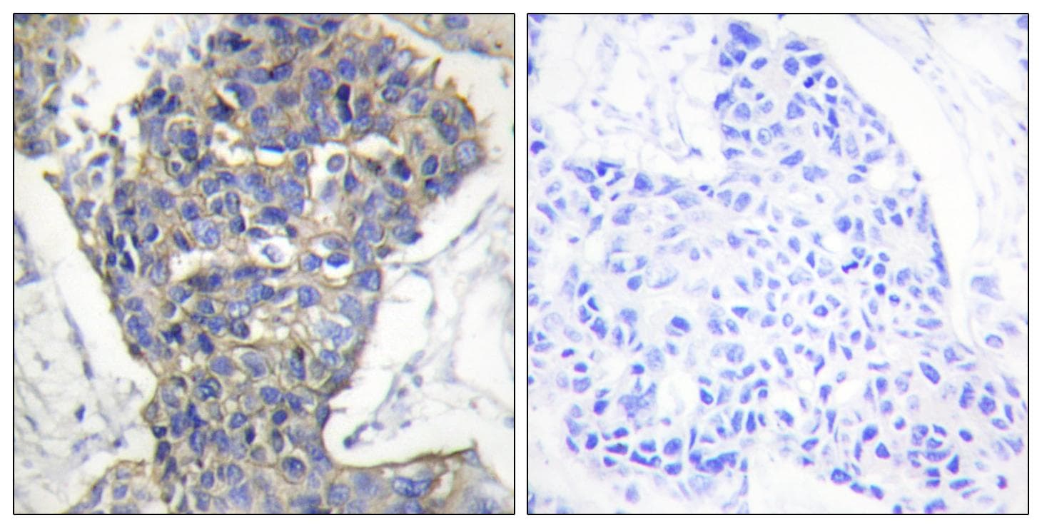 STXBP1 / MUNC18-1 Antibody (Ab-313)