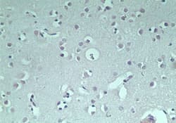 RNF128 / GRAIL Antibody (aa227-253)