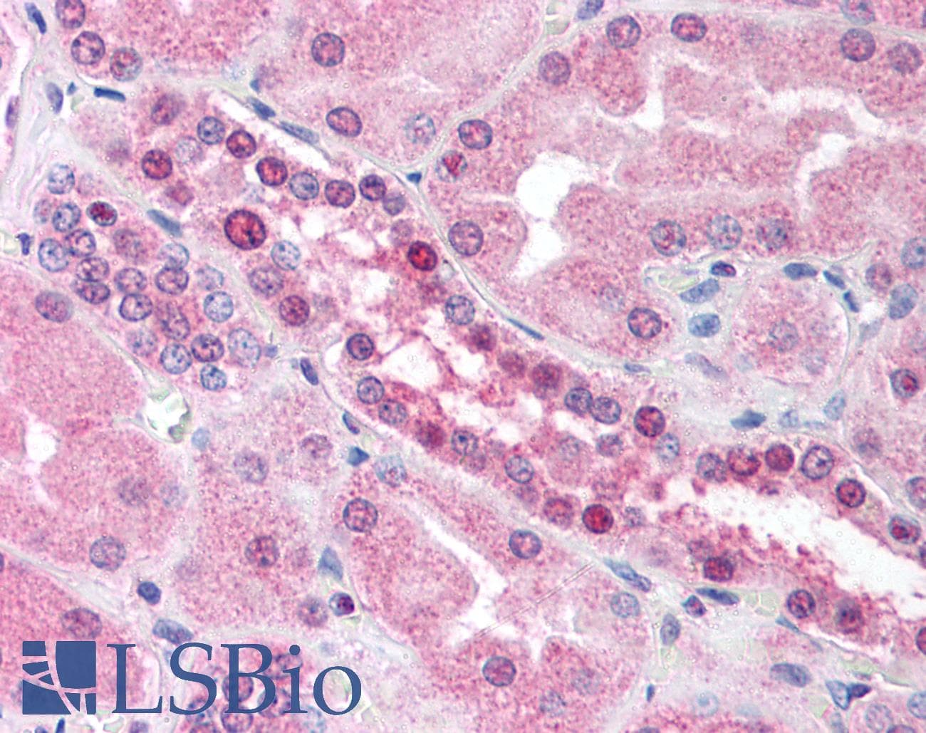 IHC-plus™ RAD54L Antibody (N-Terminus and C-Terminus, clone 60.1)