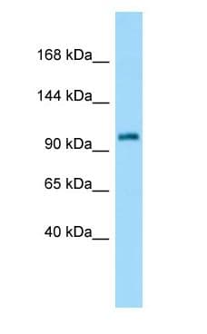 Polyclonal Rabbit anti-Rat ATXN7 / SCA7 / Ataxin-7 Antibody (N-Terminus, WB)