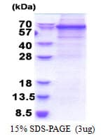 Human DDX56 Protein (Recombinant His)