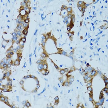 Polyclonal Rabbit anti-Human CTSE / Cathepsin E Antibody (IHC, IF, WB)
