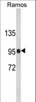 CR2 / CD21 Antibody (aa986-1014)