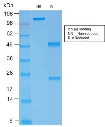 Recombinant Monoclonal Mouse anti-Human SPTA1 / Alpha Spectrin Antibody (clone rSPTA1/1833, aa356-475, IHC, WB)