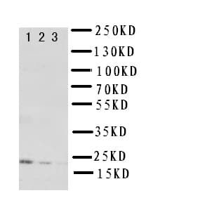 Polyclonal Rabbit anti-Rat IL-10 Antibody (aa19-178, IHC, WB)