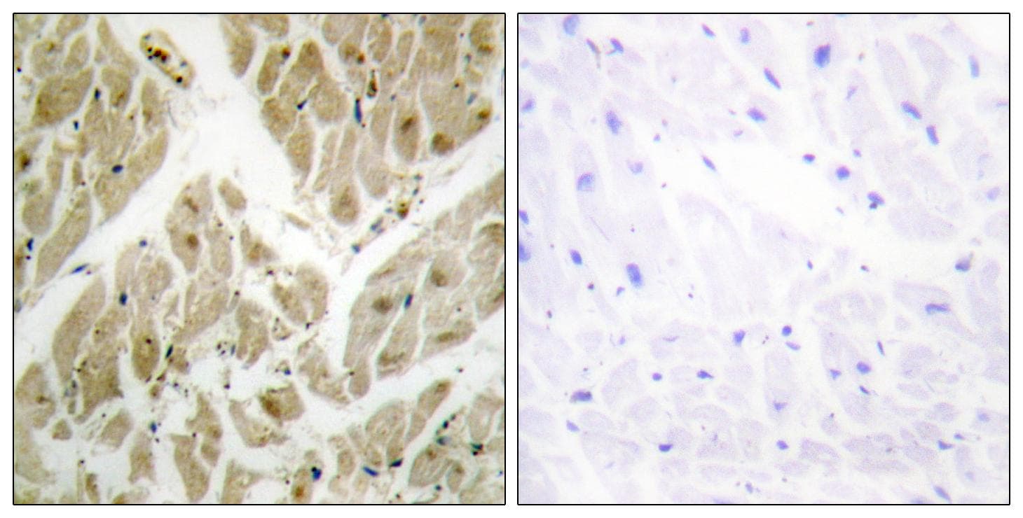 Polyclonal Rabbit anti-Human API5 Antibody (IHC, WB)
