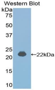 IFNA4 / Interferon Alpha 4 Antibody (aa33-189, FITC)