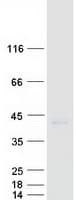 Human CENPL Protein (Recombinant Myc-DDK (Flag))