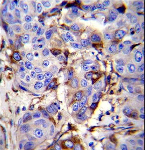 PIP / GCDFP-15 Antibody (aa77-106)