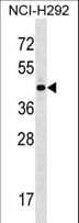 Polyclonal Rabbit anti-Human ZNF436 Antibody (aa37-65, WB)
