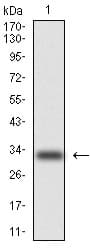 PathPlus™ KRT5 / CK5 / Cytokeratin 5 Antibody (aa158-272, clone 2C2)