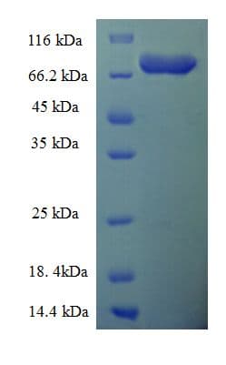 Human EPHX2 / Epoxide Hydrolase 2 Protein (Recombinant His-SUMO)