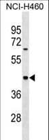 MYBPH Antibody (aa348-376)