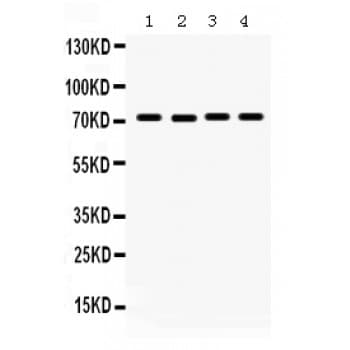 Polyclonal Rabbit anti-Human FMR1 / FMRP Antibody (aa164-200, WB)