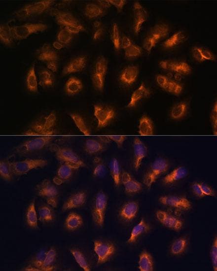 SSTR2 Antibody