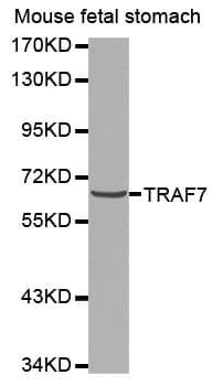 Polyclonal Rabbit anti-Human TRAF7 Antibody (IHC, WB)