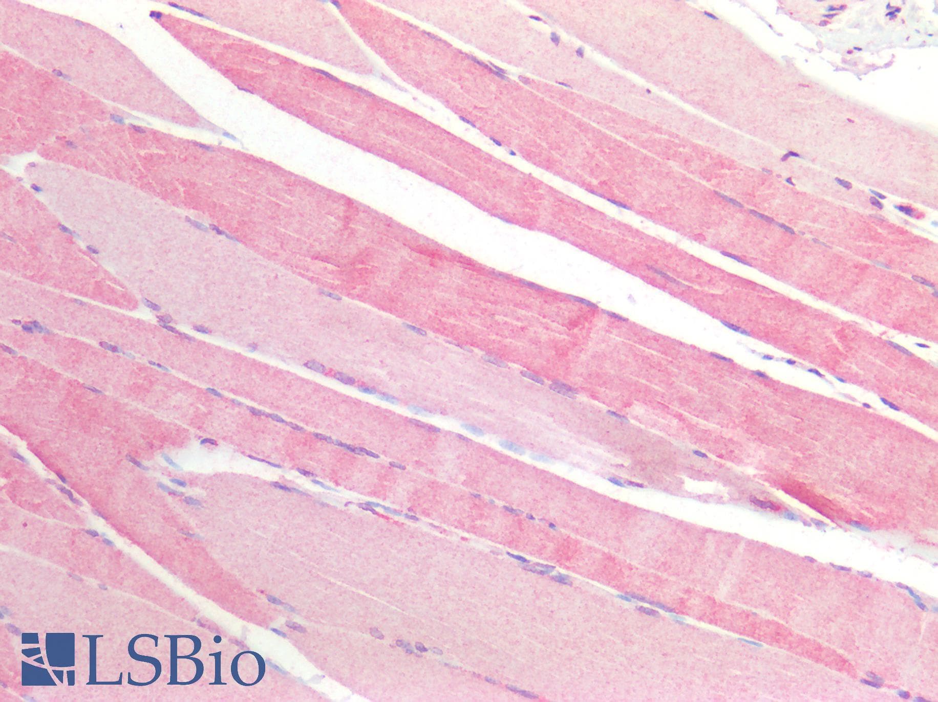 IHC-plus™ Polyclonal Rabbit anti-Human ADCY3 / Adenylate Cyclase 3 Antibody (IHC, IF, WB)