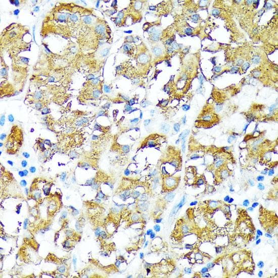 TNFRSF1A / TNFR1 Antibody