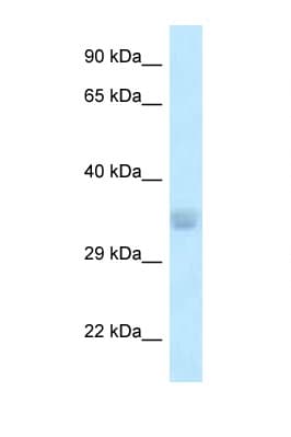 ACOT8 Antibody (N-Terminus)