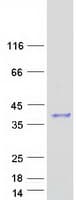 Human PGAM5 Protein (Recombinant Myc-DDK (Flag))