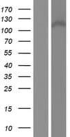 CCDC66 Protein (Over-Expression Lysate Myc-DDK (Flag))