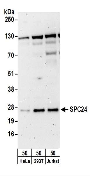 Polyclonal Rabbit anti-Human HSpc24 / SPBC24 Antibody (aa1-50, WB)
