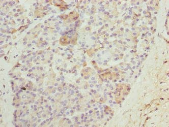 N4BP2L2 Antibody